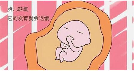 图：频繁宫缩导致孩子缺氧